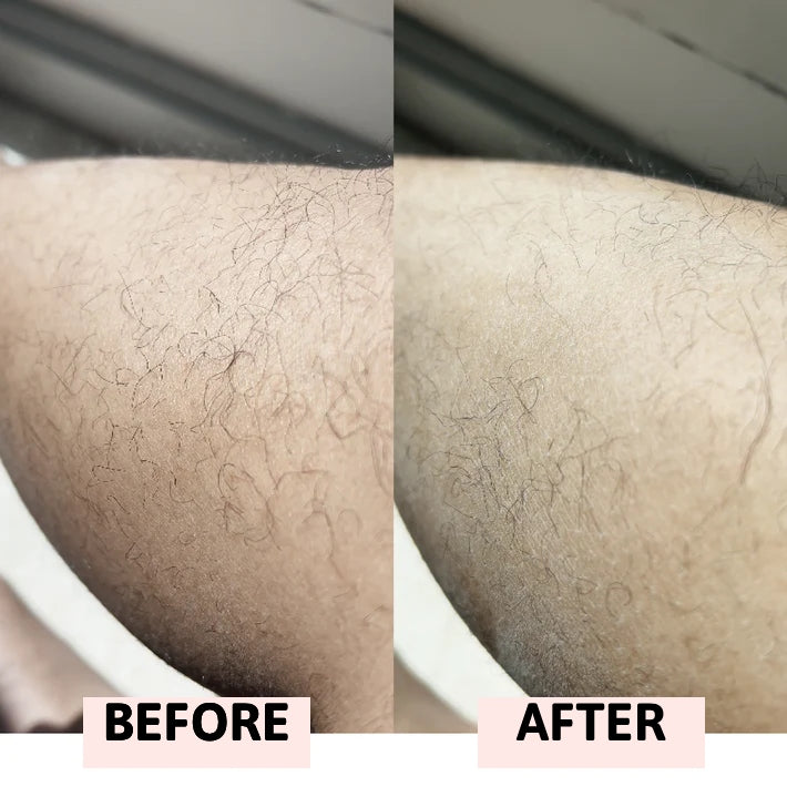 Bloosm™ Safety Razor